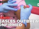 美国麻疹疫情卷土重来！南卡、密歇根相继爆发 密苏里拉响防疫警报
